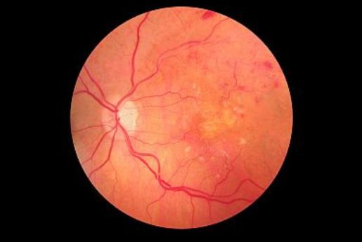 best eye hospital for diabetic retinopathy